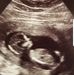 Jay-Jenn-Mike &amp; Rader Baby - Facebook