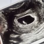 Myra Bruce - @babybruce2020 - Instagram