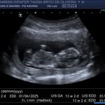Nathan Levi - @baby_nathanlevi1 - Instagram