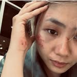 nguoibinhthuongnhungbatthuong🧛🏻‍♀️ - @n.gan.lai - Instagram
