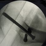 Warren Erwin Nicholas Md,MsOrtho - @warrenerwinnicholas - Instagram