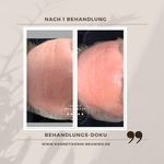 Nicole Werthmann - @fadenlifting_neuwied - Instagram