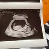 Noah Bowers - @noah.bowers8 - TikTok
