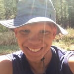 Noah Garrison - @no_hair_noah - Instagram