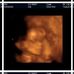 Owen Dickerson - Facebook