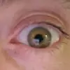 Patrick Shaughnessy - @gianteyeofdeath - TikTok