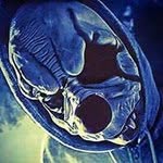 Patrick Kill - @strange_kill - Instagram