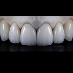 Phil Nebeker Tooth Master’s Workshop - @philnebeker - Instagram
