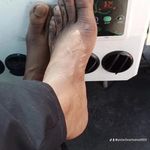 Phillip Poole - @polarbeartoenail904 - Instagram