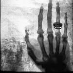 𝐓𝐡𝐞 𝐗-𝐑𝐀𝐘 𝐅𝐢𝐥𝐞𝐬 - @radiologia.desconocida - Instagram