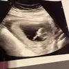 Renee Easley - @renee.easley4 - TikTok