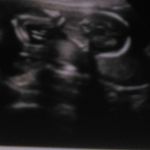 Rhonda Bratcher - @rhonda.bratcher.758 - Instagram