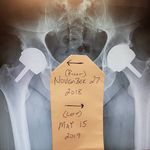 Rick Cummins - @frogrunbikeeatlive - Instagram