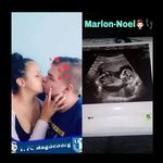Robby Rudloff - @rudloffrobby - Instagram