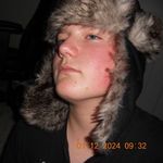 Robert Ranta - @penicillin_penguin - Instagram