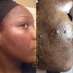 Robyn Benson - @fayettevillencskinrepair - Instagram