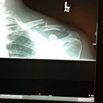Ron Bates - @bmxvr6 - Instagram