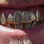 Ronnie Gold - @ronniegoldteeth - Instagram