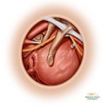 Daryl Ryan Hallman, MSMI, CMI - @hallmanmedicalillustration - Instagram
