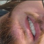 Ryan Strunk - @elite_appa - Instagram