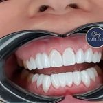Ryan Tunstall - @ococidubak - Instagram