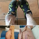 Sam Chadwick - @accessibility_physio - Instagram