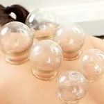 Sam Elder - @cupping_therapy_76 - Instagram