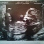 Samantha dodds - @sam_tumilty_18 - Instagram