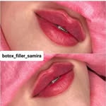 samira_Hadian - @botox_fi - Instagram