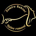 سمیرا رحیمی /ریموو تبریز / ریموو تتو/ پاک کردن تتو - @samira.rahimi_removal_tabriz - Instagram