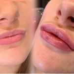 Sarah Darcy - @platinumaesthetics40 - Instagram