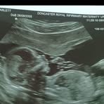 Scarlett Fleming - Facebook