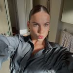 scar - @scarlett.forrest - Instagram