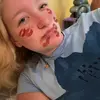 scar scar !!! - @_scarlettohuff_ - TikTok