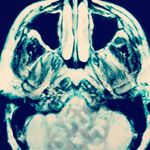 seth kott - @seth_kott - Instagram