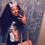 Milia milia - @thomas.shamia - Instagram