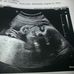 Skyler Evans - Facebook