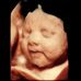 Sonya Batten - Facebook