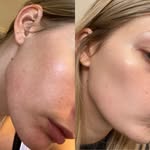 Stacie Dailey | Skincare 💚✨ - @daileyglow - Instagram