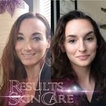 Stacey Strand - @resultsskincare - Instagram