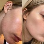 Stacie Dailey | Skincare 💚✨ - @daileyglow - Instagram