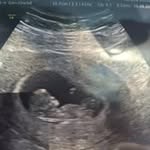 Stef Robinson - @stephmummytobe26 - Instagram