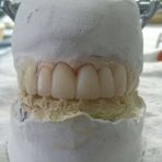 Laboratorio Dental Luz Stella Valencia Ospina - Facebook