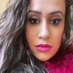 Stephanie Dellatesta- Harmonização facial - @stephaniedellatesta - Instagram