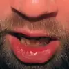 kyle crooked teeth ayers - @stephanie.2.loose - TikTok