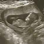 Baby to Ana & Stephen LeClerc - @baby.leclerc - Instagram