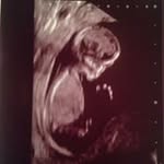 Stewart Gray - @stew.gray - Instagram