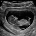 Tabitha Baughman - Facebook