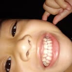Teddy Lorenzo - Facebook