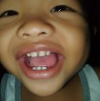 Teddy Suarez - Facebook
